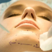 چگونه جراحی غبغب به جوان سازی چهره کمک میکند؟ جراحی غبغب, جوان سازی چهره